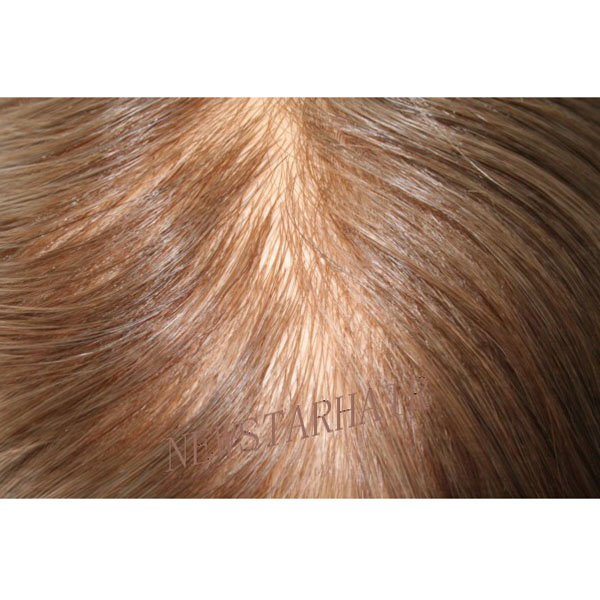 Injected skin 拷贝.jpg